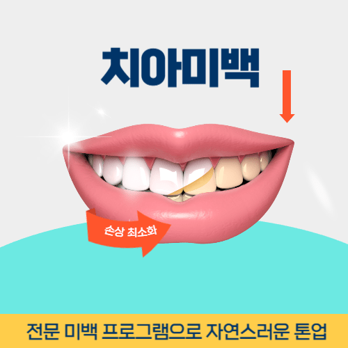 시흥치과 시흥시 치과 치아미백