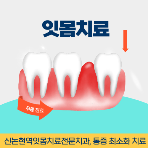 시흥치과 시흥시 치과 잇몸치료